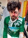 Kırmızı kart gören futbolcu, rakibinin yüzüne tekme atıp yaraladı
