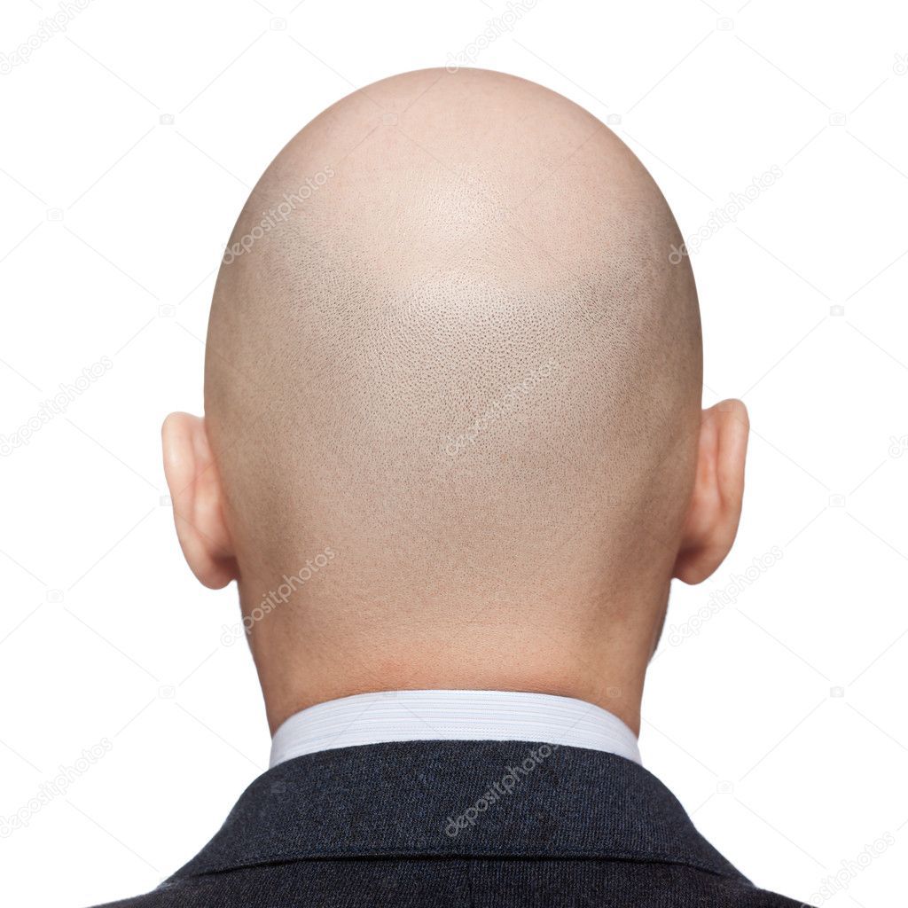 depositphotos_9966728-stock-photo-bald-man-head.jpg