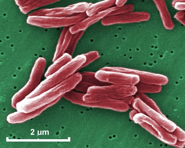 mycobacterium tuberculosis 030.jpg