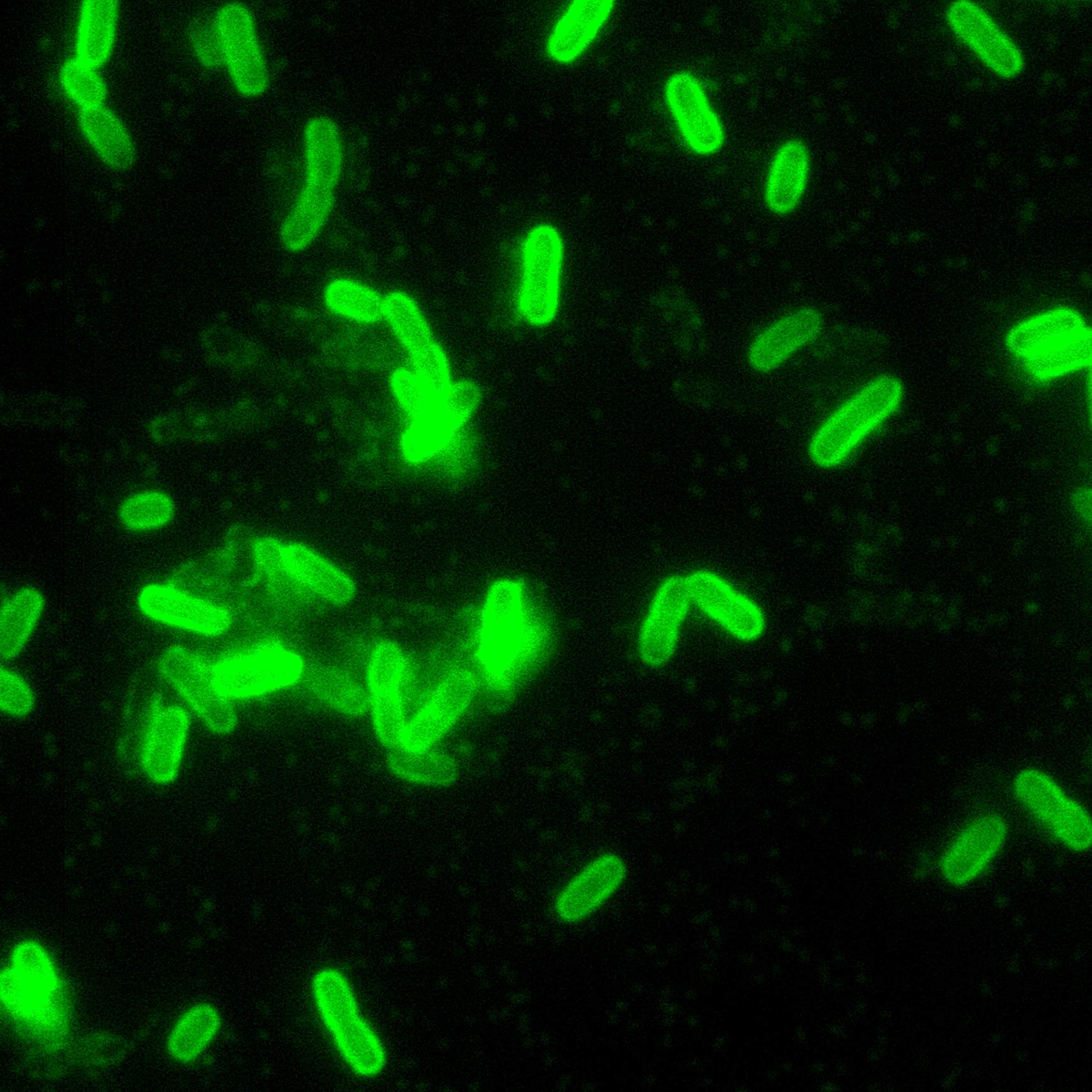 yersinia-pestis-direct-fluorescent-antibody-stain-dfa-200x-magnification.jpg