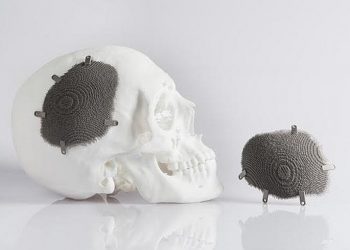 Autodesk, Tıbbi 3D Baskı Alanında İlerliyor