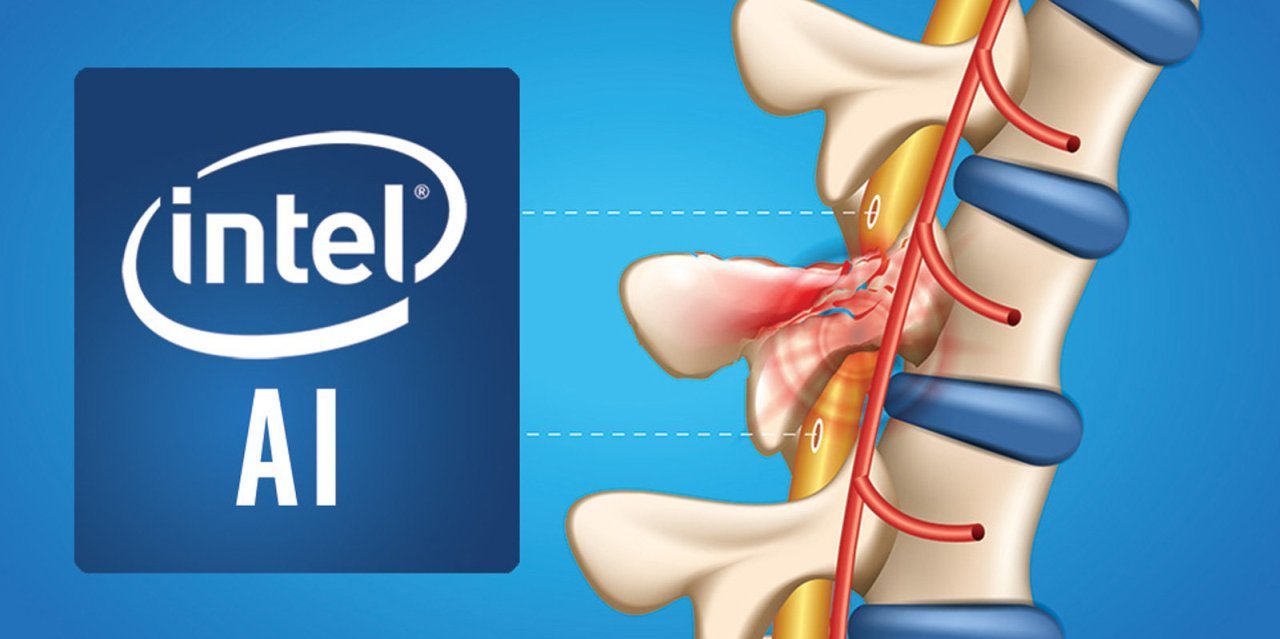 Intel Hasarlı Spinal