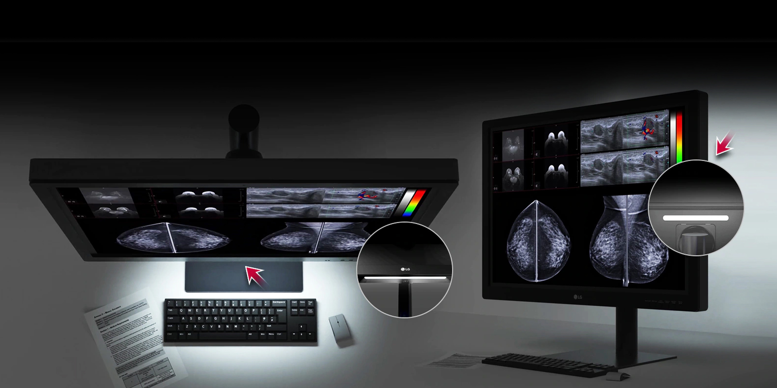 LG Teşhis Monitörü