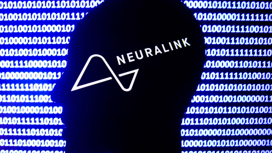 Neuralink insan deneyleri